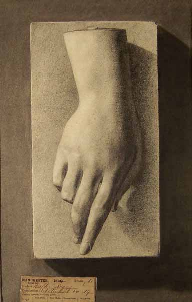 Plaster cast of a hand.